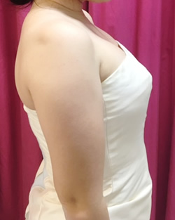 ブライダルインナー着用後の写真