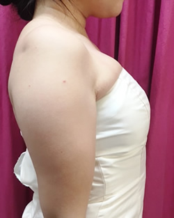 補正下着着用前